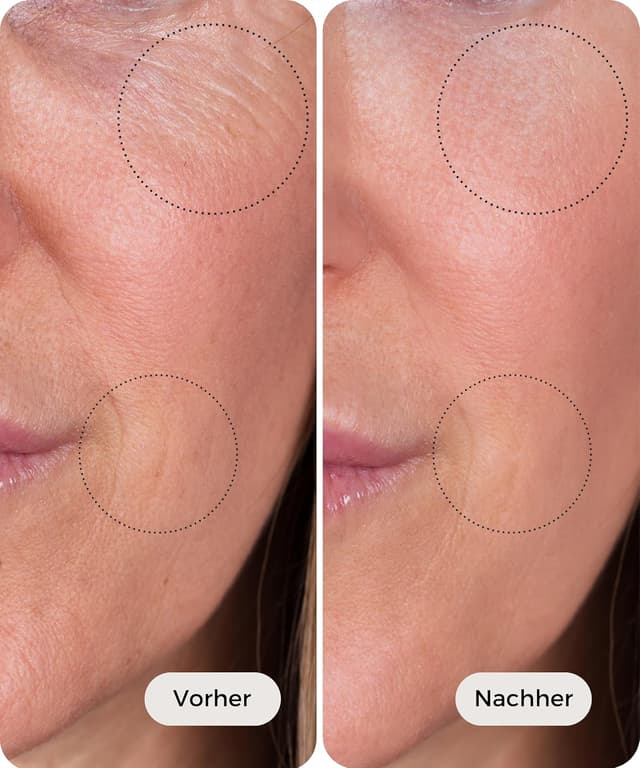 Detalle 2 de Bakuchiol Öl Serum 2% mit 30 ml Meina