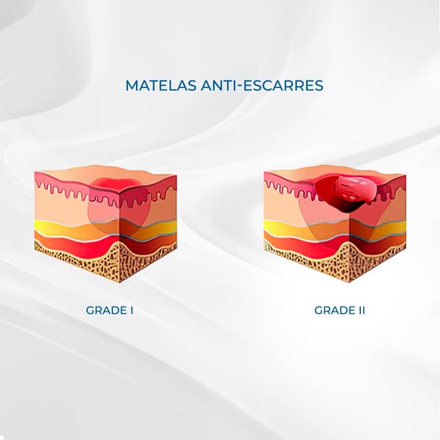 Thumbnail 5 de Mobiclinic Mobi 2 Matelas anti-escarres 20 alvéoles