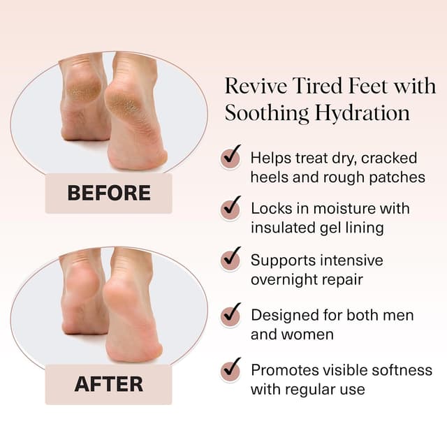 Thumbnail 2 de Kitsch Moisturizing Socks for Cracked Heels 1 pair