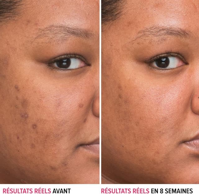 Thumbnail 1 de IT Cosmetics Bye Bye Dark Spots Serum