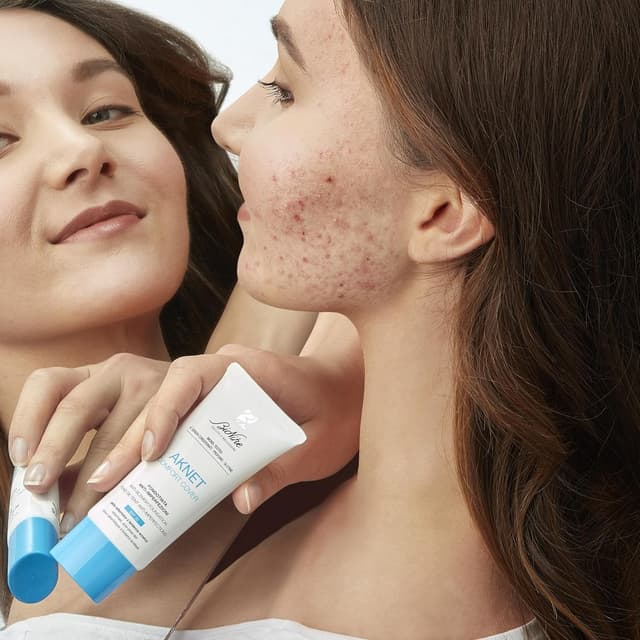 Detalle 2 de BioNike Aknet Comfort Cover 104 Biscuit 30 ml