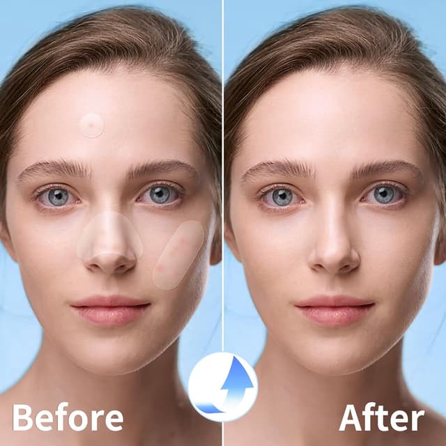 Detalle 2 de QUSTERE Large Pimple Patches 380 Count