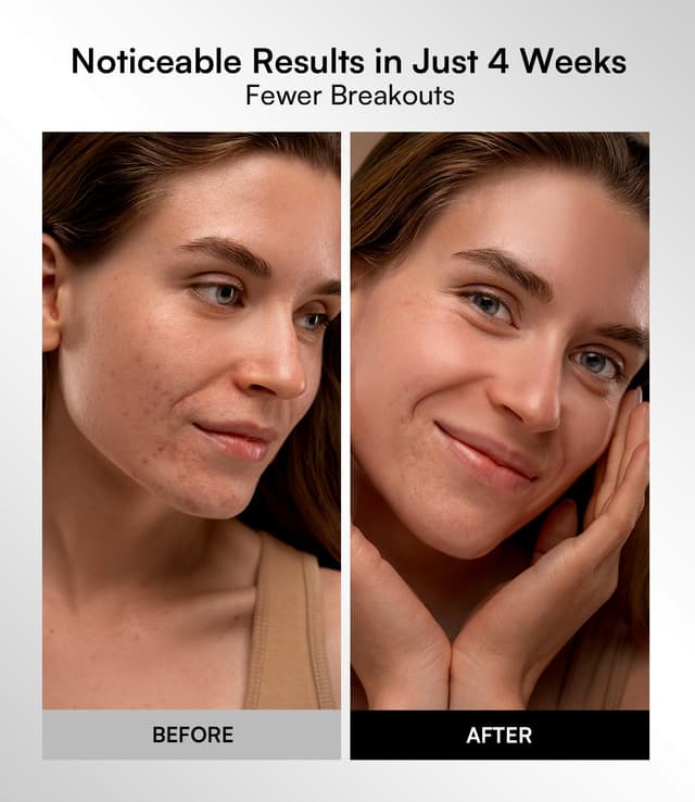 Thumbnail 5 de INIA Red Light Therapy Mask 2600mAh 🧖♀