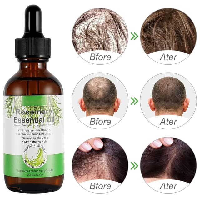 Thumbnail 3 de Rosmarinöl 60 ml für Haarwachstum