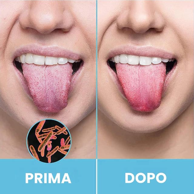 Detalle de HOKIN Raschietto Lingua in acciaio antimacchia: pulisci lingua per adulti (confezione da 2)