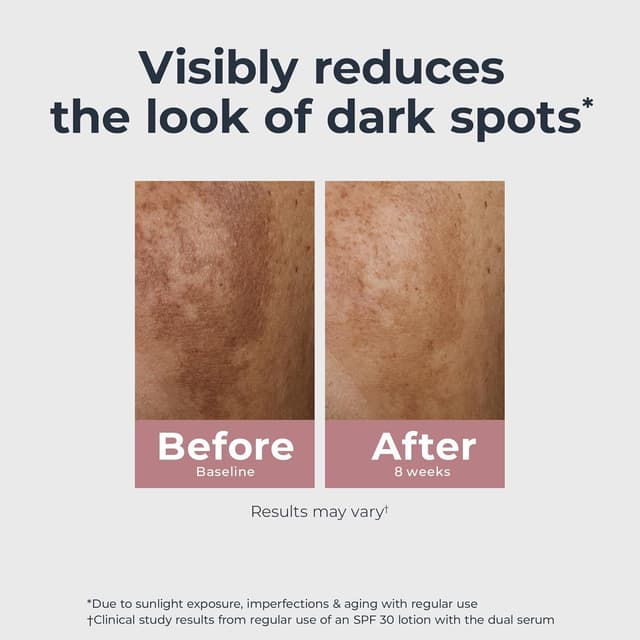 Detalle de Eucerin Radiant Tone Dual Serum for Dark Spots (1 fl oz)