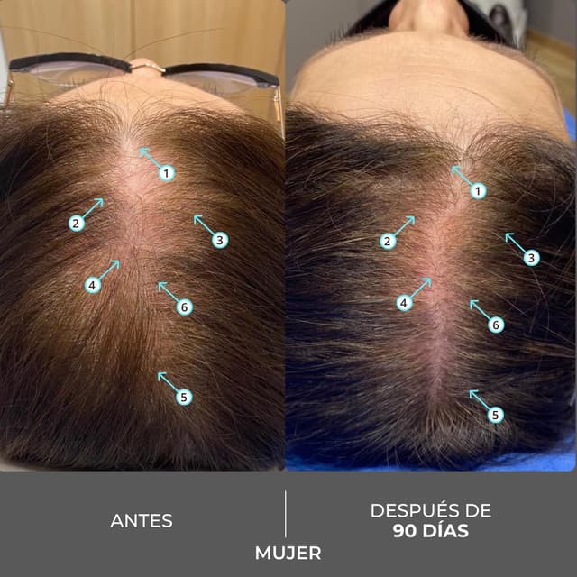 Thumbnail 5 de DS Laboratories Revita Extra Strength 205 ml