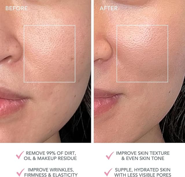 Thumbnail 4 de FOREO LUNA 4 plus cepillo limpieza facial