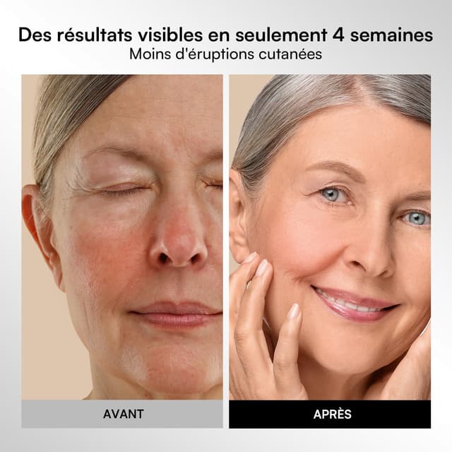 Thumbnail 5 de INIA Masque LED 220 perles 💆