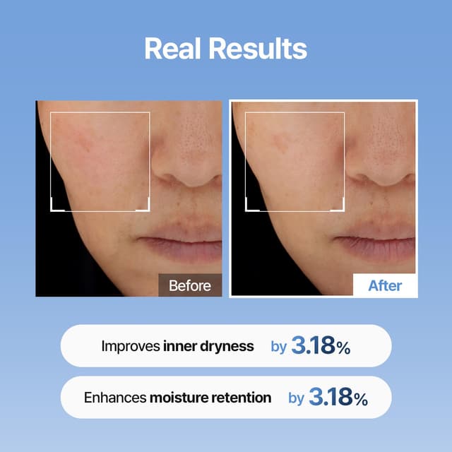 Detalle de Meditherapy Hyaluronic Acid Serum XXL 150ml (5.07 fl.oz.) – Ultra Hydrating, Non-Sticky Anti-Aging Face Serum