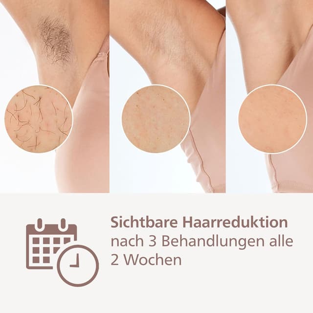 Detalle 2 de Philips Lumea IPL 9900 Series (BRI950/02) mit SenseIQ & SkinAI – Alternative zur Laserhaarentfernung, 2 Aufsätze für Körper & Gesicht