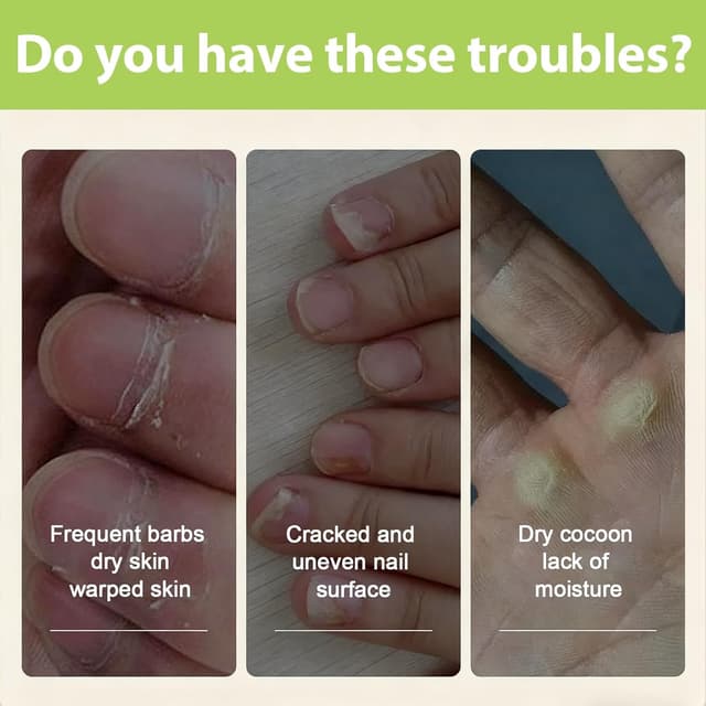 Thumbnail 5 de Aceite para uñas y cutículas 20ml