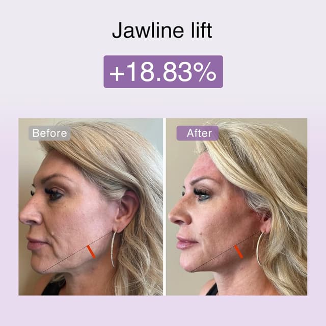 Detalle 2 de DermRays M1 microcurrent beauty device