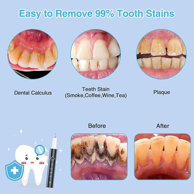 Detalle 1 de Zahnsteinentferner Zahndusche 4 Modi IPX7