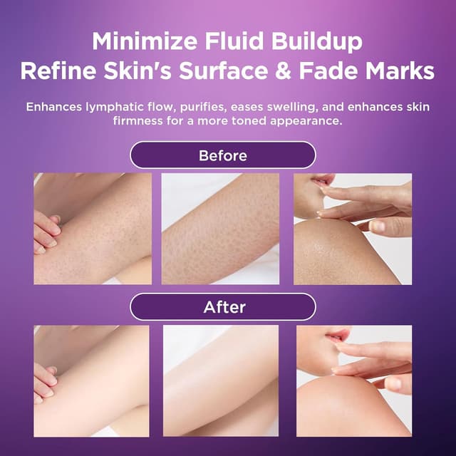 Detalle 2 de Lymphatic Drainage Massager anti-cellulite body sculpting tool with microcurrent, heat, vibration & LED therapy