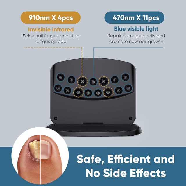 Thumbnail 1 de Nagelpilz Lasergerät 15 LEDs