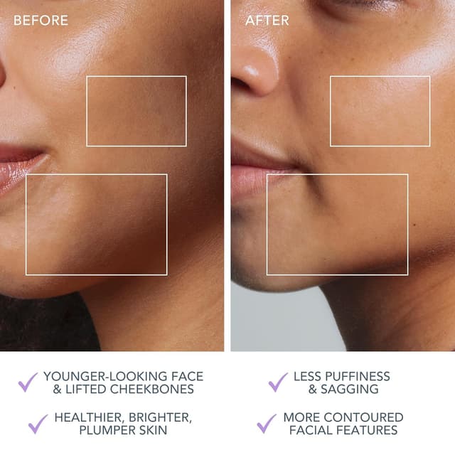 Thumbnail 4 de FOREO BEAR 2 go Mikrostrom Face Lifting