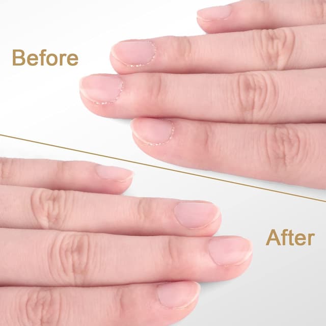 Thumbnail 6 de Nagelhautzange mit Schieber Edelstahl