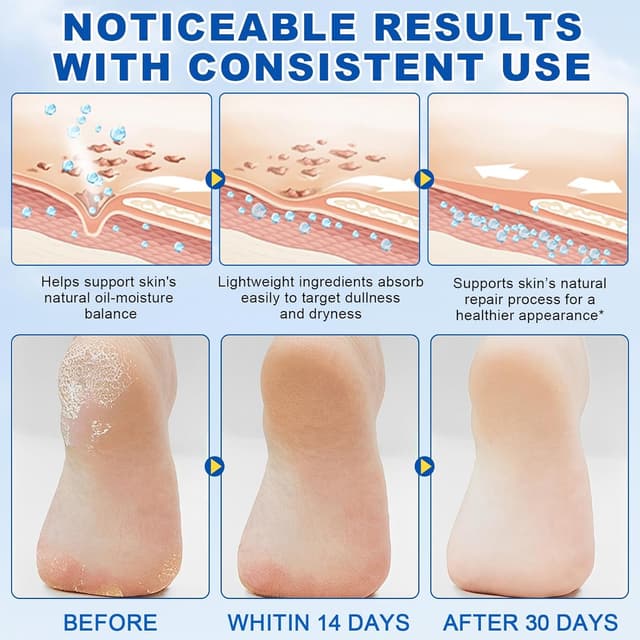 Thumbnail 4 de 60% Urea Foot Care Stick