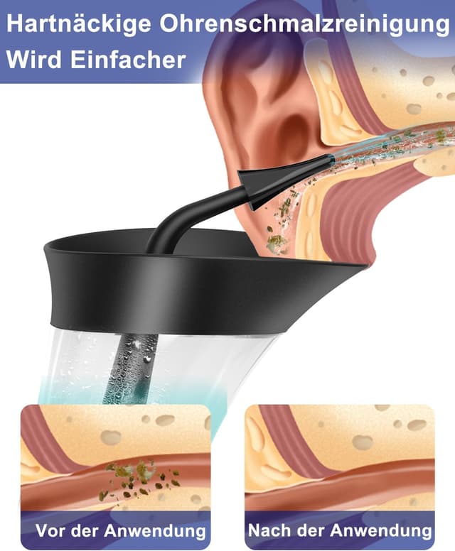 Thumbnail 2 de Mecmic Nettoyage Oreille 1200 mAh