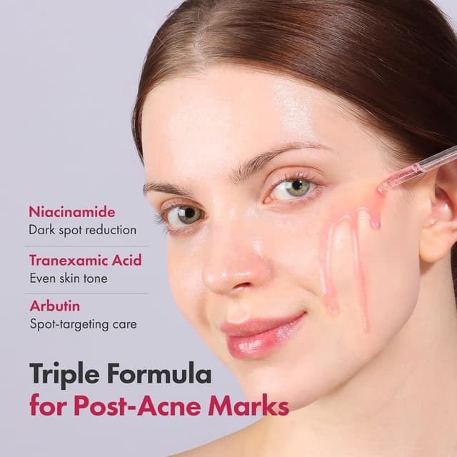 Detalle 2 de TOSOWOONG Niacinamid 10% Serum 33 ml