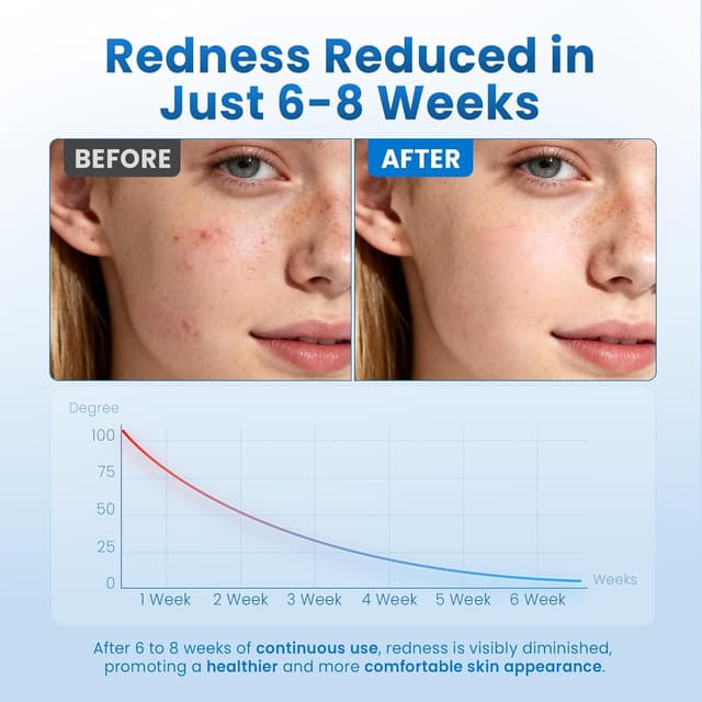 Detalle 1 de Borje Face Towels XL, 10 x 12 in