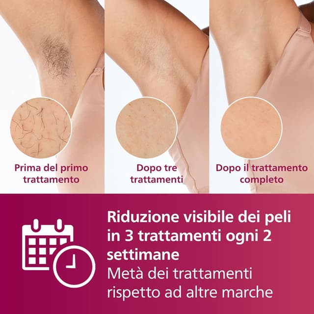 Thumbnail 2 de Philips Lumea 7000 epilazione IPL 250.000 impulsi 🪒