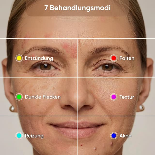 Detalle 2 de Nanoleaf LED-Lichttherapie-Gesichtsmaske mit 7 Modi, tragbare Rotlichtmaske & NIR-LEDs