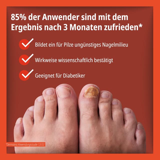 Detalle de Evolsin® Anti-Nagelpilz Liquid – Medizinprodukt gegen Nagelpilz an Händen & Füßen, auch für Diabetiker