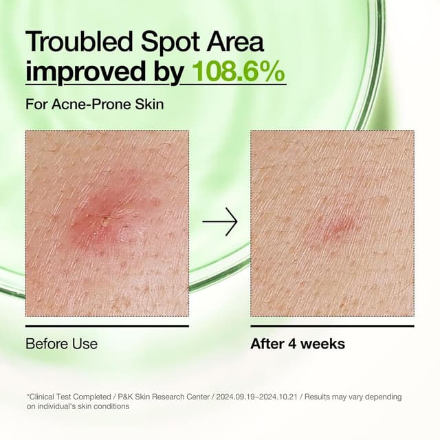 Detalle 2 de Anua Azelaic Acid 10 Serum for Redness 30ml