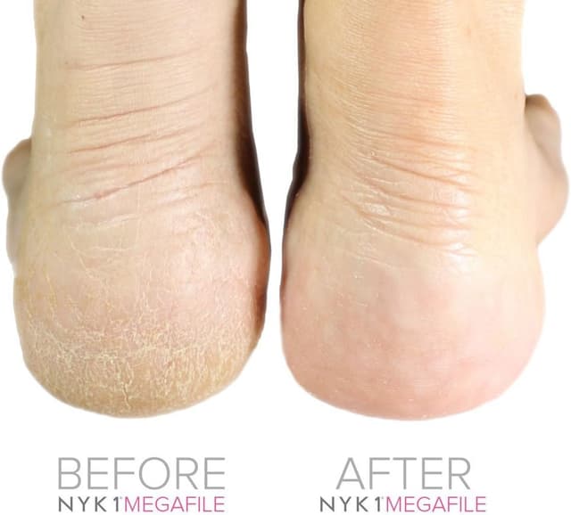 Detalle de NYK1 Pink MegaFile Foot File & Smoothie pedicure rasp bundle