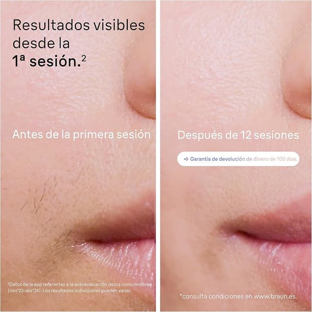 Thumbnail 3 de Braun Skin i·expert IPL depilación 4 cabezales