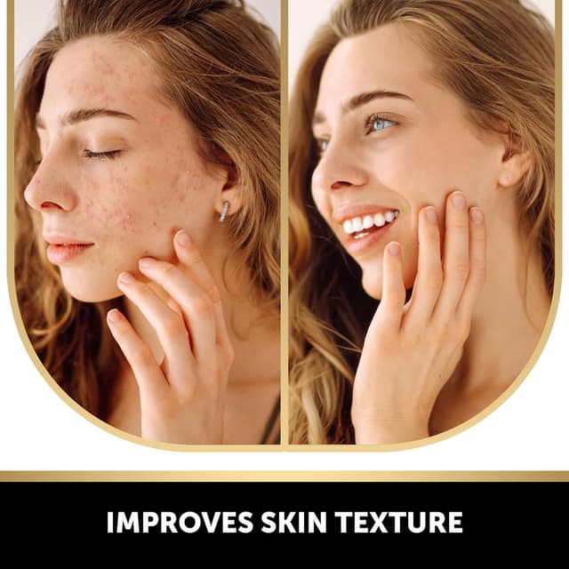 Detalle de Valitic Kojic Acid Soap Bars 4 Pack