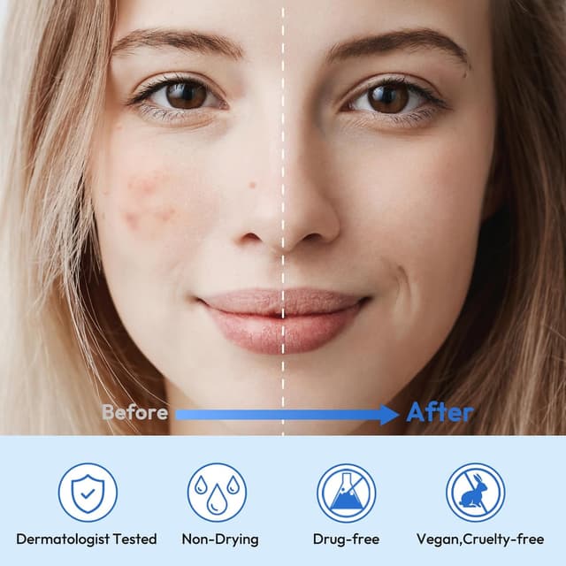 Detalle 2 de Breiboz Hydrocolloid Acne Patches 25 ct