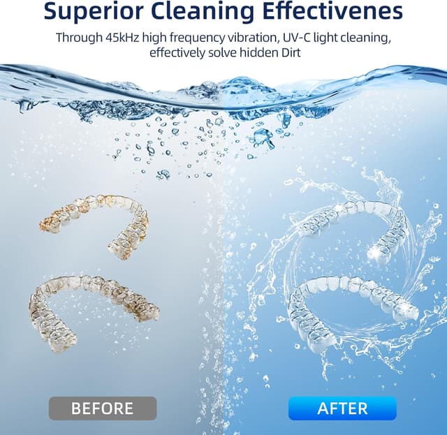 Detalle 2 de Opilea 45kHz Retainer Cleaner 4‑Mode 🦷