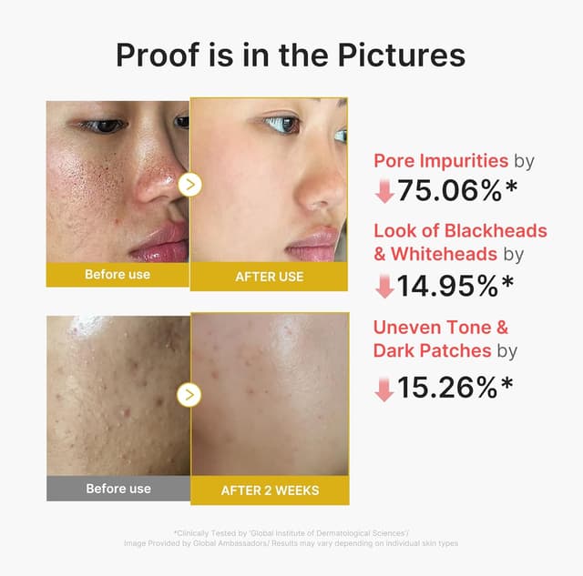 Thumbnail 3 de medicube Peel Shot 2.7 fl.oz