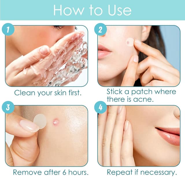 Thumbnail 4 de Pickel Patch 264 Stück Pimple Patches 🩹