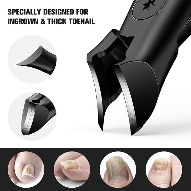 Detalle 2 de FERYES Wide Jaw Thick Toenail Clippers for Thick Toenails with Catcher (Precision Stainless Steel)