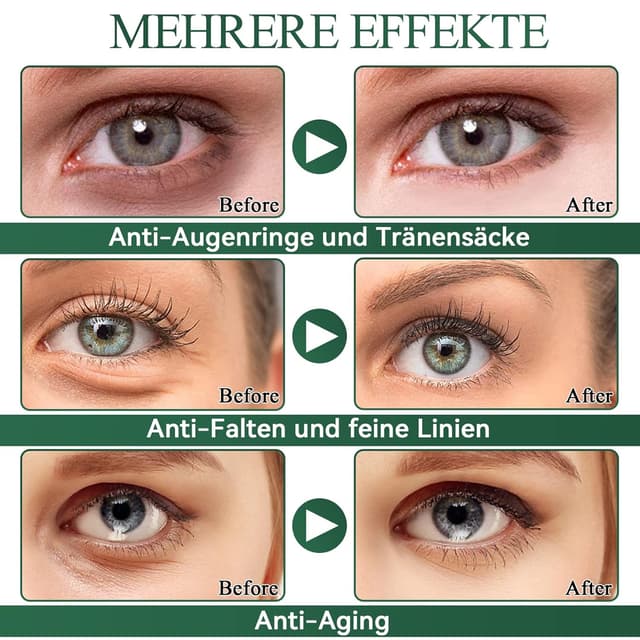 Detalle de Eveellyn Augenpads (60 Stück) mit Aloe Vera-Extrakt gegen Augenringe, Tränensäcke & Falten