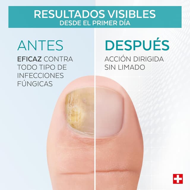 Thumbnail 2 de PODERM Tratamiento antifúngico para uñas de pies