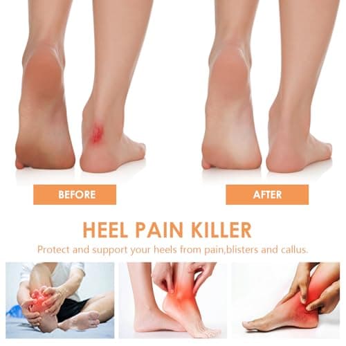 Thumbnail 1 de 12 paires de coussinets de talon auto-adhésifs pour baskets, noir et blanc ⚙