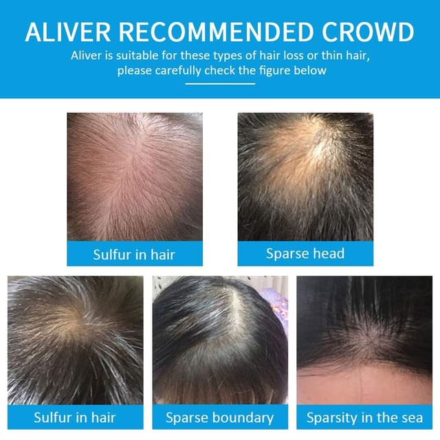 Thumbnail 6 de Aliver Hair Fibers for Thinning Hair (Dark Brown) — Undetectable Natural Formula