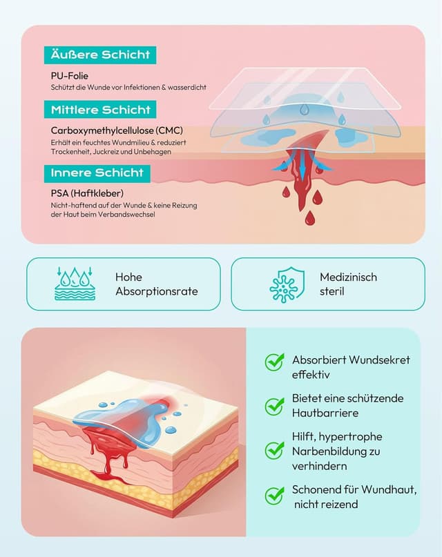 Detalle de daidora Hydrokolloid-Rolle Gesundheitspflaster 5×300 cm (Pickel Patch Rolle) mit Positionierstreifen