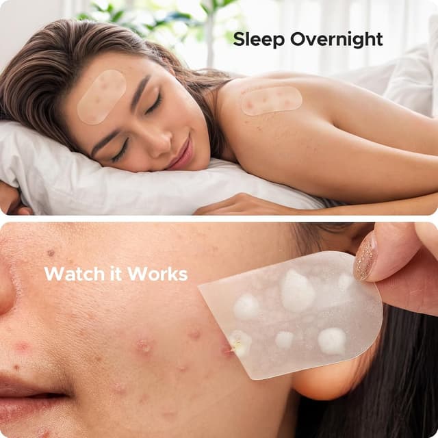 Detalle 2 de TKTK XL hydrocolloid acne patches 124 count