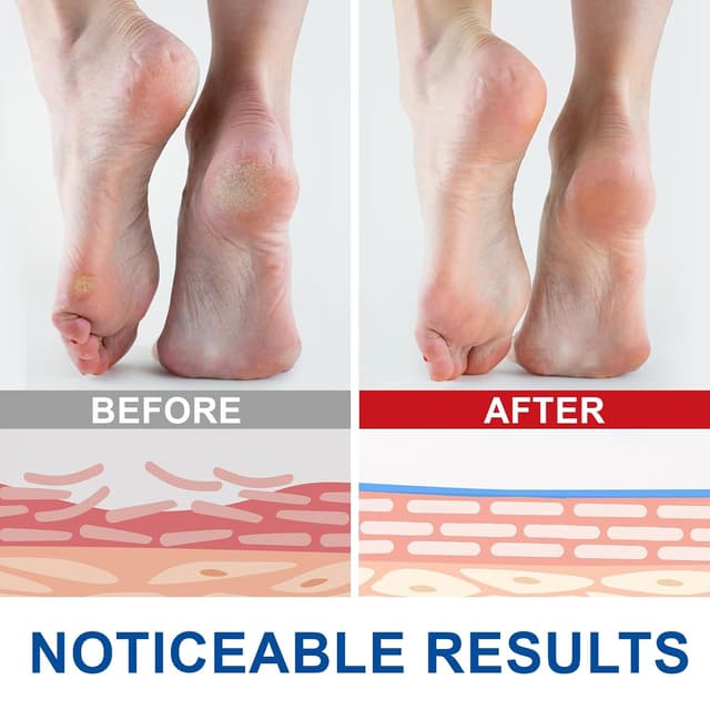 Detalle 2 de Urea Creme 60% für Füße