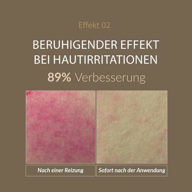 Thumbnail 5 de MIZON SNAIL ALL IN ONE REPAIR CREAM 75ml