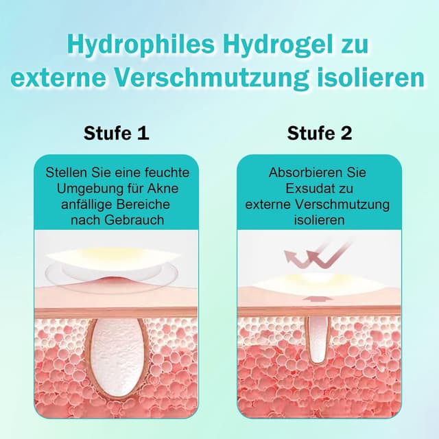 Thumbnail 5 de Pimple Patches Pickel Patch 264 Stück