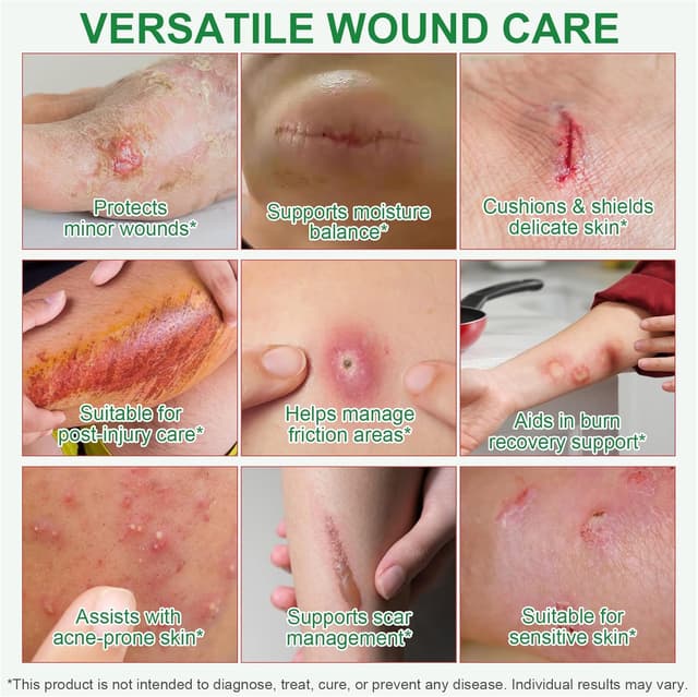 Detalle 2 de Hydrokolloid Pflaster Rolle 5cm x 150cm