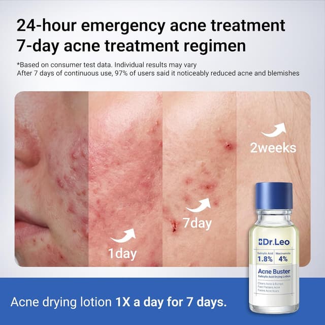 Thumbnail 6 de Dr.Leo 1.8% Salicylic Acid Spot Serum (20 ml) for Acne-Prone Sensitive Skin