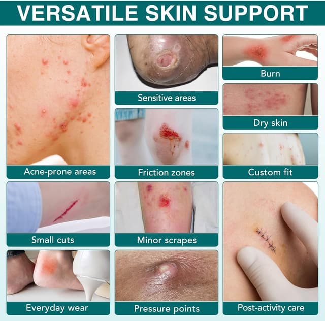 Thumbnail 2 de Rollo hidrocoloide 5 cm x 3,6 m para heridas 🩹